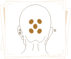 骨相大全—五花驄枕骨